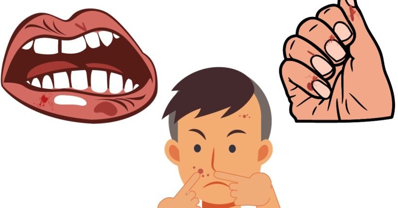 صورة قضم الاظافر ونتف الجلد